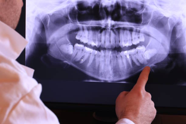 Best Emergency Treatment for Dental Infections or Abscesses in Decherd, TN